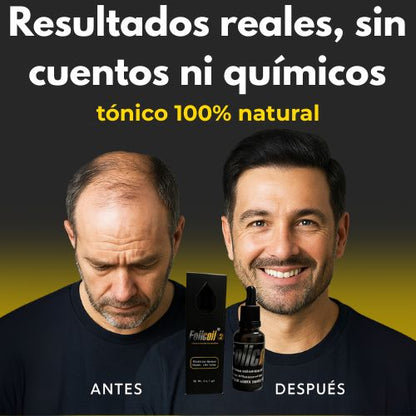Tonico capilar FOLICOIL recupera tu cabello sin quimicos