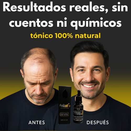 Tonico capilar FOLICOIL recupera tu cabello sin quimicos
